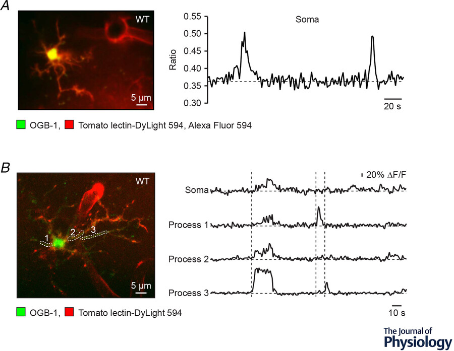 The role of intracellular calcium-store-mediated calcium signals in in vivo sensor and effector functions of microglia